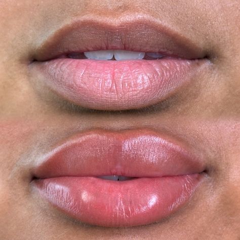 . . . . . . . . . . #lips #lipblushing #pmuartist #raleighnc #raleighlipblush #cosmetictattoo #naturalpmu #neutralization #ncbrows #microbladingraleigh #raleighlipfiller #lipstick #lipcolor Lip Blushing Brown Skin, Lip Neutralization Before And After, Lip Blush Aesthetic, Lip Blushing Black Women, Lip Filler Before And After Black Women, Natural Lip Fillers 1ml, Lip Filler Black Women, Natural Lip Fillers 0.5ml, Lip Filler Styles