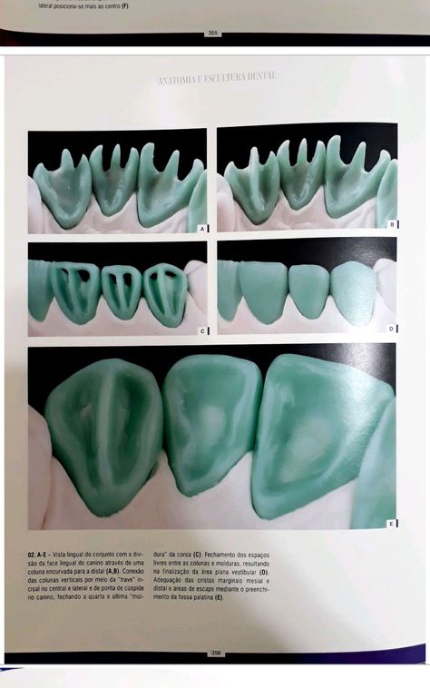 Dental Lab Technician, Dentist Art, Dental Aesthetics, Dentistry Student, Dental Anatomy, Dental Fun, Dental Technician, Dental Design, Dental Laboratory