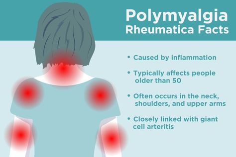 Sjogrens Syndrome, Jaw Pain, Sciatic Nerve Pain, Bone Loss, Neck And Back Pain, Diet Foods, Upper Arms, Nerve Pain, Autoimmune Disease