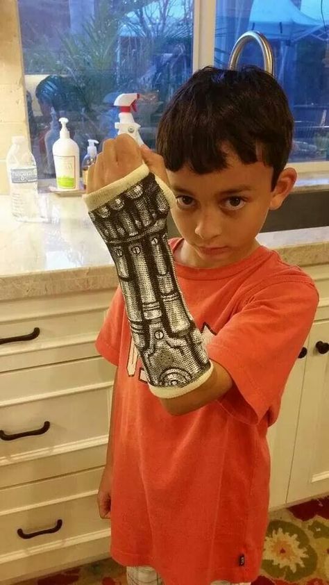 Paper paint robot arm on cast Arm Cast Painting, Hand Plaster Fracture, Cast Drawing Ideas Arm, Cast Art Arm, Arm Cast Decorating Ideas, Walking Cast Boot, Broken Arm Cast, Halloween Cast, Walking Cast