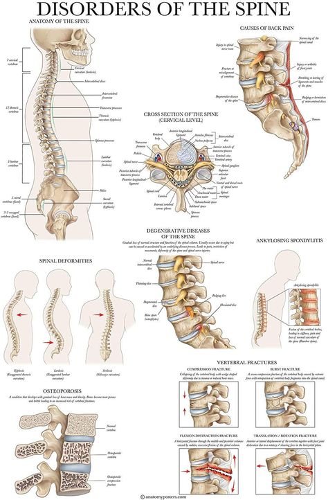 Spine Anatomy, Secret Paris, Human Skeleton Anatomy, Anatomy Poster, Learning Disorder, Skeleton Anatomy, Basic Anatomy And Physiology, Spinal Nerve, Muscle Anatomy