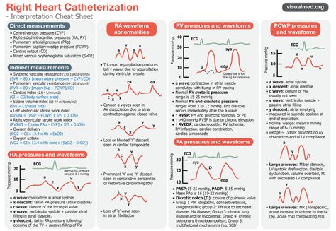 Right Heart Catheterization Cheat Sheet: Interpretation ... Cardiac Cath Lab Nurse, Cath Lab Nursing, Central Venous Pressure, Cardiac Cath, Cath Lab Nurse, Nursing Planner, Heart Catheterization, Cardiology Nursing, Ekg Interpretation