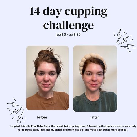 what's facial cupping and does it work, is cupping worth it, primally pure discount code, how to use facial cups, cupping, TCM, lments of style Face Cupping Before And After, Facial Cupping Before And After, Cupping Face, Benefits Of Facial Cupping, Silicone Cupping Therapy, What Is Cupping Therapy, Face Cupping, Primally Pure, Baby Balm