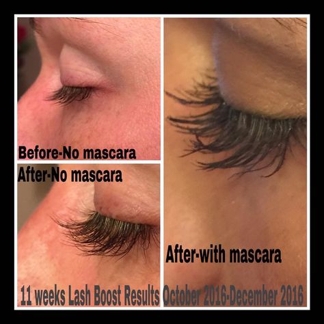 HOLY LASHES!!  Check out my Friend and teammate Lauren's lashes!! #RFLashBoost is the real deal! Our amazing Doctors are so smart!! Today is the last day to get Lash Boost with 2 free items!! Don't delay!! Message me!! Http://mpineda.myrandf.com Dry Skin Face, Rodan And Fields Consultant, Brightening Eye Cream, Extra Long Hair, Dump Ideas, Lash Boost, Life Changing Skincare, Eyelash Serum, Natural Eyelashes