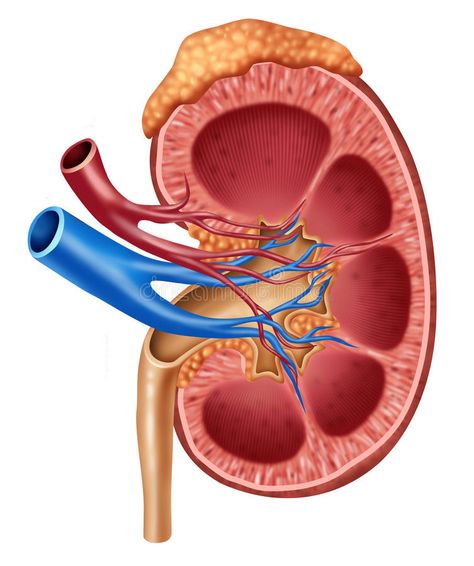 Distraught. Black Human Kidney, Kidney Pain, Chest Congestion, Medical Illustration, Anatomy And Physiology, Anatomy, Disease, Human Body, Indonesia