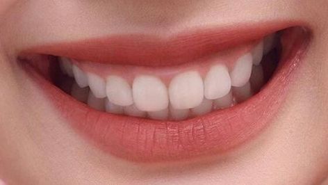 V34 Colour Corrector, Teeth Aesthetic, Pretty Teeth, Colour Corrector, Beautiful Teeth, Whitening Teeth, Gummy Smile, Perfect Teeth, Smile Teeth