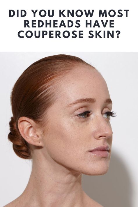 Did You Know Most Redheads Have Couperose Skin? Redhead Cool Skin Tone, Ginger Hair On Cool Skin, Redhead Color Analysis, Colors For Red Heads To Wear, Color Palette For Redheads, Best Clothing Colors For Gingers, Copper Hair Fair Skin Green Eyes, Natural Red Hair Aesthetic, Red Head Makeup Natural