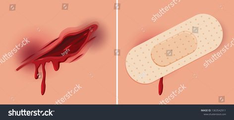 Set of fresh wound illustration #Ad , #ad, #fresh#Set#illustration#wound Craft Templates, Womens Flip Flop, Stock Vector, Royalty Free Stock Photos, Royalty Free, Stock Images, Stock Photos, Quick Saves