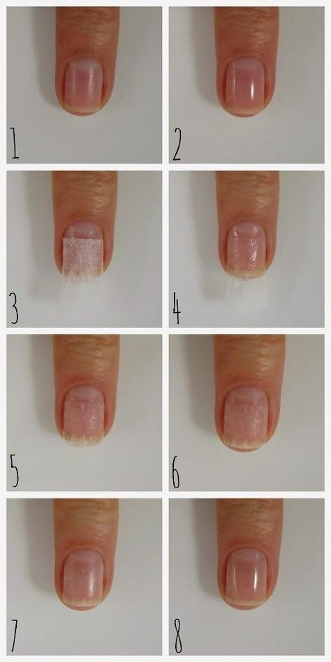 Nail Care: Tea Bag Nail Patching Technique | Dahlia Nails | Bloglovin’ Fix Broken Nail, Nails After Acrylics, Split Nails, Broken Nails, Nail Repair, Damaged Nails, Nail Care Tips, Brittle Nails, Strong Nails