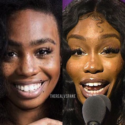 Sza Singer Before And After Surgery, Sza Singer Nose Contour, Alpo Martinez, Sza Singer, Filters Instagram, Nose Contour, Digital Computer, Photoshop Filters, Nose Surgery