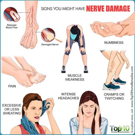 Chronic Back Pain, Top 10 Home Remedies, Back Pain Remedies, Lower Back Pain Relief, Nerve Pain Relief, Muscle Weakness, Sciatic Nerve Pain, Nerve Damage, Sciatic Nerve