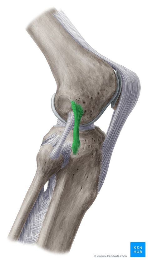 Anterolateral ligament - lateral view Ankle Anatomy, Avulsion Fracture, Types Of Fractures, Knee Bones, Knee Ligaments, Anterior Cruciate Ligament, Anatomy Bones, Magnetic Resonance Imaging, Muscle Anatomy