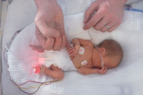 💜World Prematurity Day💜⁠ ⁠ Finn was born at 26 weeks, weighing 2lb 9oz. He spent 3 months in an incubator, cared for by his parents as well as the amazing nurses, on hand 24/7. ⁠ ⁠ #worldprematurityday #preemie #preemiebaby #nicu #tinybutmighty⁠ ⁠ ⁠ 28 Week Preemie, Bayi Prematur, Prematurity Day, World Prematurity Day, Director Of Nursing, Preemie Baby, Nurse Watch, Birthday Card Craft, Preemie Babies