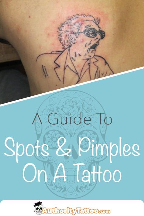 Tattoos To Cover Up Back Acne, Back Acne Tattoo Cover Up, Tattoo Oil, Do Tattoo, Tattoo Healing Process, Tattoo Care Instructions, Learn To Tattoo, Tattoo Cream, Pimples Remedies