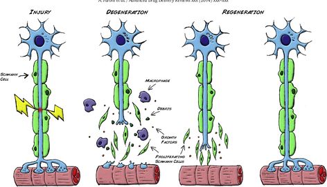 Figure 1 from Peripheral nerve regeneration: experimental strategies and future perspectives. | Semantic Scholar Peripheral Nerve Injury, Tissue Engineering, Peripheral Nervous System, Medical Pictures, Peripheral Nerve, Platelet Rich Plasma, Adrenal Glands, Medicine Journal, Regenerative Medicine