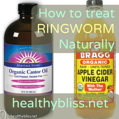 What is ringworm and how to treat it naturally | Jennifer Thompson How To Get Rid Of Ring Worms On Skin, Natural Ring Worm Remedies, Ring Worm Essential Oils, Ringworms In Humans Remedies, Deworming Humans Diy, Ring Worm Remedies, Sick Tips, Illness Remedies, Ring Worm