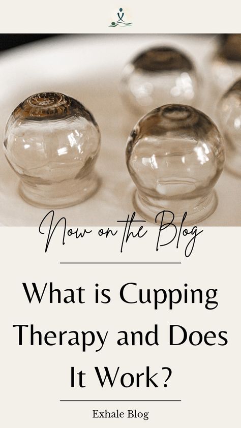 Cupping Therapy Points, Cupping Therapy Chart Trigger Points, Vacuum Cupping Therapy, Cupping Therapy Chart Back Pain, How To Use Cupping Therapy, What Is Cupping Therapy, Wet Cupping, Declutter House, Holistic Therapy