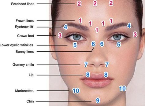 Botox Eyebrow Lift Injection Sites <b>eyebrows</b>, plastic surgery Botox Eyebrow Lift, Eyelid Wrinkles, Botox Injection Sites, Injection Sites, Facial Injections, Botox Injection, Botox Brow Lift, Head Muscles, Eyebrow Lift