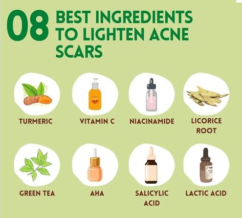 8 best ingredients to lighten acne scars Scar Lightening Diy, Acne Pit Scars, Spotless Skin, Lighten Scars, Turmeric Vitamins, Skincare Instagram, Homemade Laundry, Skin Care Face Mask, Scar Removal