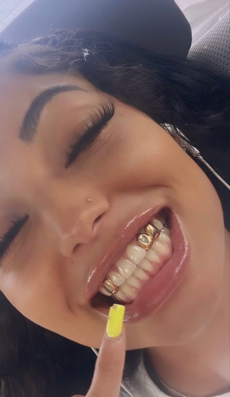 Cute Grills For Women, Girls With Grills, Gold Teeth Grills, Open Face Grillz, Girl Grillz, Pretty Teeth, Dental Jewelry, Grillz Teeth, Teeth Caps