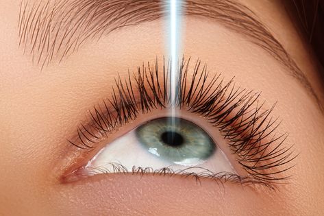 Lasik Eye Surgery Aesthetic, Eyes Surgery, Discord Call, Perfect Eyesight, Refractive Errors, Corneal Transplant, Goals 2025, Laser Vision Correction, Journal Pictures