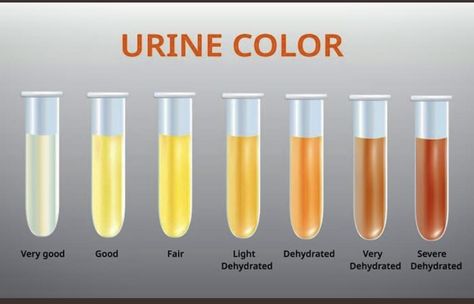 Color Of Urine, Urine Color, Cold Buster, Baileys Recipes, Health Secrets, Turmeric Water, Dog Urine, Frequent Urination, Peaceful Mind