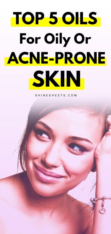 Do you ever feel intimidated to use oils in your skincare routine because your skin is oily or acne-prone? That's totally unnecessary! You can enjoy the benefits of precious skincare oils even with oily skin - the secret is to pick the ones that won't clog your pores. Here are the best picks for your delicate skin! | ShineSheets.com | Skincare routine, skin care, acne skin, oily skin, acne-prone skin, how to deal with acne, best oils for skincare, oily skin tips, acne tips #skincare #acne #skin Oily Skin Face, Oily Skin Remedy, Oily Skin Acne, Oily Face, Routine Skin, Acne Oil, Oil Skin Care, Face Acne, Oily Skin Care