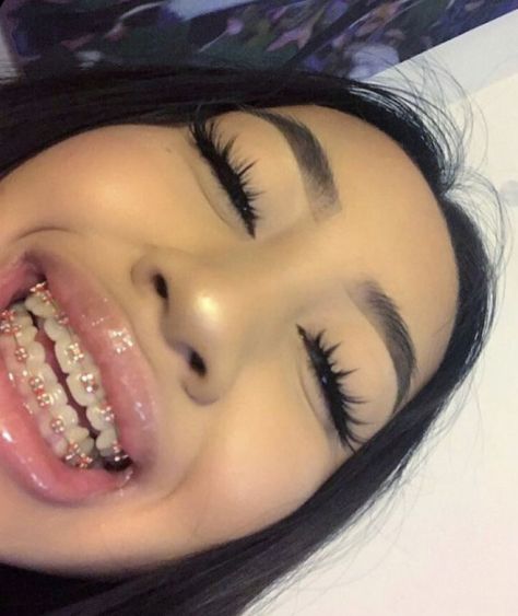 Best Color Braces, Pink Braces, Cute Braces Colors, Pretty Teeth, Braces Tips, Getting Braces, Eyes Ideas, Braces Girls, Cute Braces