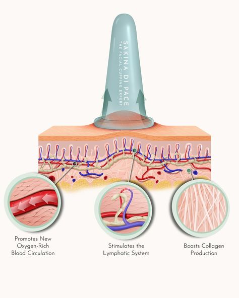 ABOUT FACIAL CUPPING… How does facial cupping work? Let me try to answer this question as simply as I can. By delicately lifting the layers of your skin, facial cupping creates space for improved circulation of blood, lymph, and Qi, fostering a healthier complexion from within. This process not only promotes the release of tension and fascia adhesions, which can lead to wrinkles and sagging, but also triggers the skin’s natural healing response. Through controlled suction, facial cupp... Skin Care Process, Facial Cupping Benefits, Cupping Techniques, Cupping Face, Face Cupping, Facial Massage Steps, Facial Aesthetic, Benefits Of Cupping, Lymph Flow