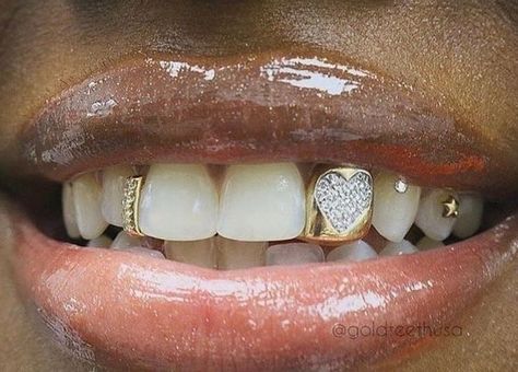 Snake Teeth, Rapper Costume, Tooth Cap, Teeth Caps, Gold Grill, See True, Justine Skye, Grills Teeth, Gold Teeth