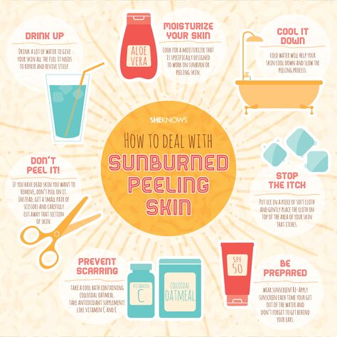 Dealing with sunburned peeling skin Sunburn Face, Sunburn Peeling, Sunburn Skin, Sunburn Remedies, Skin Drinks, Sunburn Relief, Natural Acne Remedies, Natural Acne, Sun Burn