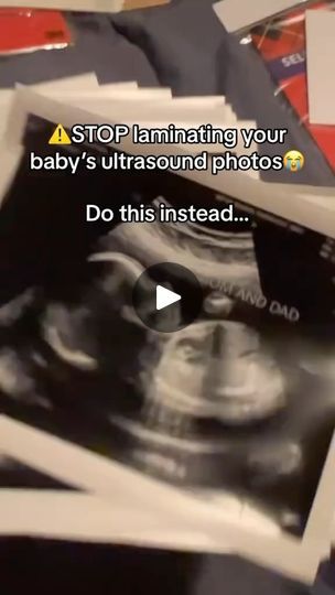 795 reactions · 88 shares | Primegeg on Reels | theprimegeg · Original audio | Reels Ultrasound Video, Video Frame, Everything Will Be Fine, First Ultrasound, Baby Things, Ultrasound, Love At First Sight, Pregnancy Announcement, The Live