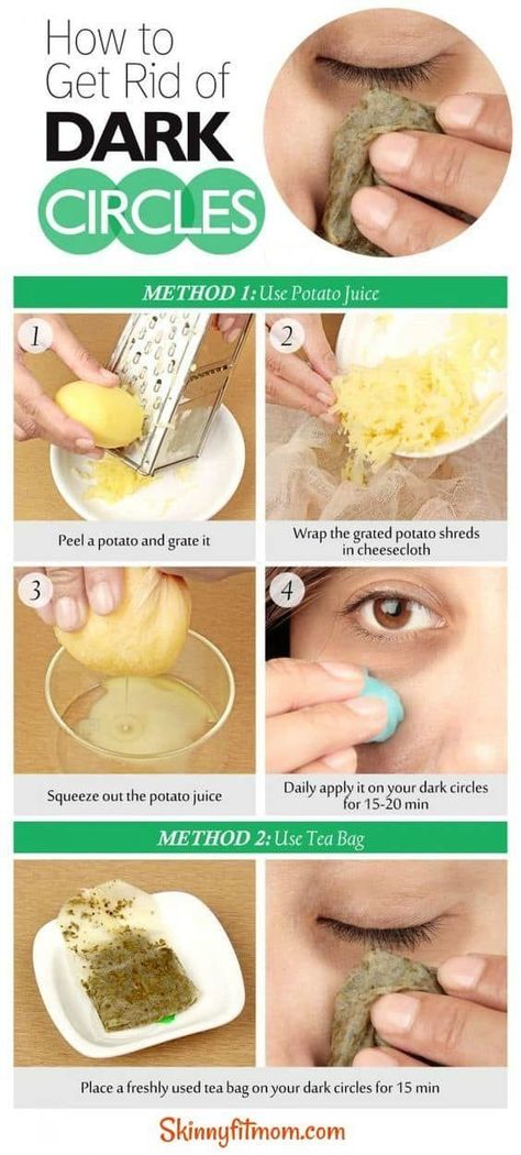 Dark Circle Remedies, Potato Juice, Remove Dark Circles, Under Eyes, Dark Circles Under Eyes, Beauty Remedies, Skin Remedies, Skin Care Remedies, Natural Home Remedies