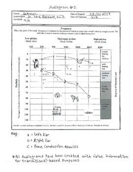 I have created 20 example audiograms on speech bananas, along with a Reading the Audiogram Worksheet that the student will complete with each corresponding audiogram. I have also created an Answer Key for the Reading an Audiogram Worksheets. The student will identify the following information about each audiogram:  The location of where the audiogram was completed  The date the audiogram was completed  The number of the audiogram  The Type of Hearing Loss (i.e., Unilateral or Bilateral)  The Kin Hearing Loss, Answer Keys, Work Ideas, Teacher Store, Me Now, Teacher Pay Teachers, Bananas, Educational Resources, Teachers Pay Teachers