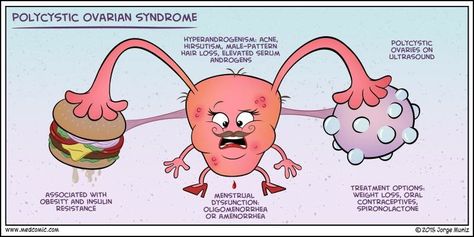 istudyiwin: “Wanted to share these because I love them! All credits to: medcomic.com ” Nursing Mnemonics, Pa School, Polycystic Ovarian Syndrome, Med Surg, Medical School Studying, Medical Examination, Nursing Tips, Nursing Study, Nursing Education