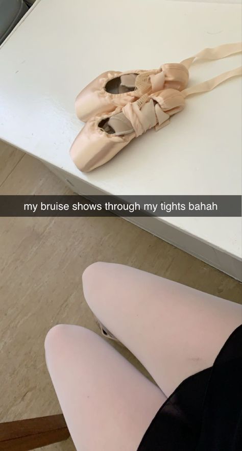 Pointe Shoes Aesthetic, Ballet Injuries, New Pointe Shoes, Doc Martens Mary Janes, Aesthetic Insta Story, Checkered Nails, Ballet Legs, Swarovski Swan, Ballet Academy