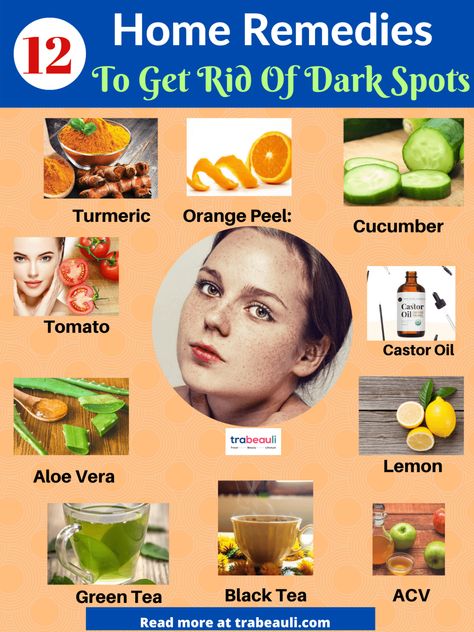 How To Get Rid Of Dark Spots With Home Remedies [Overnight] – Best Beauty Lifestyle Blog Pigmentation Remedy, Facial Ideas, Get Rid Of Spots, Dark Spot Remover For Face, Easy Blanket, Skin Care Home Remedies, Brown Spots On Skin, Healthy Face, Dark Spots On Face