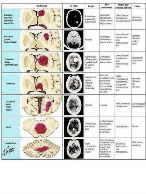 Pharmacy School Study, Medical Radiography, Mri Brain, Radiology Student, Radiology Imaging, Brain Surgeon, Nursing Study Guide, Medical School Life, Medicine Notes