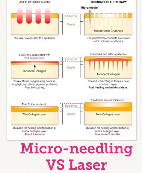 Interesting #infographic about the differences between #microneedling and #laserskinresurfacing... the benefits are clear! #skinpenprecision gets incredible results for #antiageing and reducing the appearance of #pigmentation #acne and #acnescarring! Want to learn more about the safest #microneedling pen device with ingress protection to prevent contamination? Click link in bio to learn more! #dermapen #dermaroller #doctors #medicalaesthetics #aesthetics #aestheticians #beauticians #nurses #skin Dermapen Microneedling, Microneedling Pen, Skin Needling, Laser Skin Resurfacing, Derma Pen, Derma Roller, Medical Aesthetic, Aesthetic Ideas, M Beauty