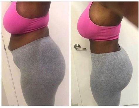 Mia Aesthetics ATX on Instagram: “Jaw dropping results by @el_jefe_alvarez 😍. . . Procedure: 💉Lipo360 // Brazilian Butt 🍑Lift. Height: 5’4. Weight: 166 lbs. Post-Op: 5…” Lipo 360 Before And After Black Women, Brazilian Buttlift Surgery Results, Lipo 360 Before And After, Breast Lift Surgery Before And After, Lipo 360, But Lift, Tummy Tucks Recovery, Lipo Before And After, Woman Motivation