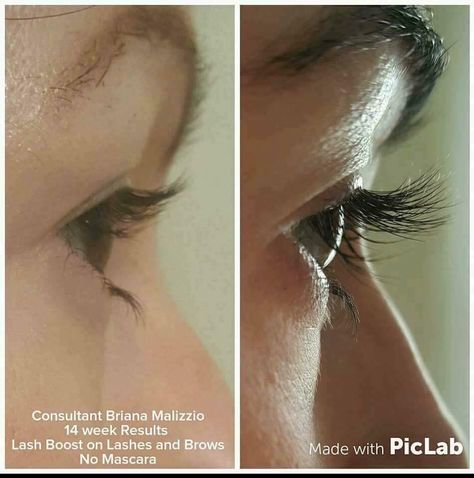 Dry Eyelids, Rodan Fields Lash Boost, Rodan And Fields Consultant, Eye Wrinkle Cream, Lash Boost, Life Changing Skincare, Skincare Regimen, Eyelash Serum, Lash Serum