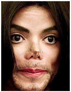 RIP Michael Plastic Surgery, Michael Jackson, Surgery