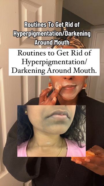 Hydroquinone And Tretinoin, How To Get Rid Of Hyperpigmentation, Hyperpigmentation Around Mouth, Get Rid Of Hyperpigmentation, Azelaic Acid, Kojic Acid, August 20, Glycolic Acid, Care Routine