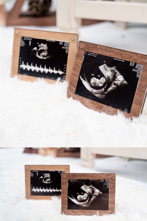 ultrasound picture frame Sonogram Picture Frame, Ultrasound Picture Frame, Ultrasound Frame, Baby Sonogram, Sonogram Pictures, Picture Frame Wood, Ultrasound Pictures, Wood And Acrylic, Wood Acrylic