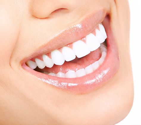 Zoom Teeth Whitening, Dental Photos, Cosmetic Dentistry Procedures, Dental Images, Pretty Teeth, Discolored Teeth, Beautiful Teeth, Perfect Teeth, Smile Teeth