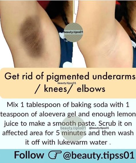 How To Whiten Underarms, Exposed Skin Care, Beginner Skin Care Routine, Skin Care Pictures, Face Skin Care Routine, Clear Healthy Skin, Natural Skin Care Remedies, Diy Skin Care Routine, Skin Care Face Mask