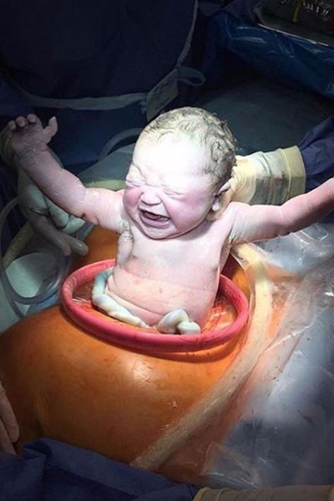 This C-Section Birth Photo Will Blow Your Mind No Matter How Many You've Seen Birth Pictures, Cesarean Section, Healthy Mummy, Are You Not Entertained, Birth Photos, Hospital Photos, Delivery Photos, Mom Junction, Birth Photography