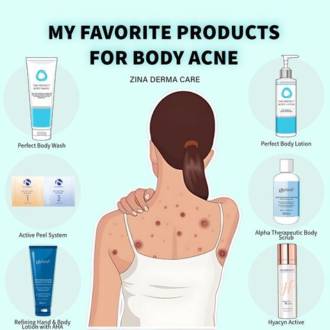 🌟 MY FAVORITE PRODUCTS FOR BODY ACNE 🌟 I want to share some amazing products that can help you with body acne. These products are super easy to use and have worked wonders for our clients 🩵Perfect Body Wash: This body wash is gentle and effective. It helps clear up acne, leaving your skin feeling fresh and clean. If you have KP you absolutely need this!!! 🩵Perfect Body Lotion: Say goodbye to body acne with this lightweight lotion. It controls oil, prevents breakouts, and gives you smoothe... Clear Up Acne, Acne Lotion, Organization Notes, Back Acne, Body Acne, School Organization Notes, Oil Skin Care, Sensitive Skin Care, School Organization