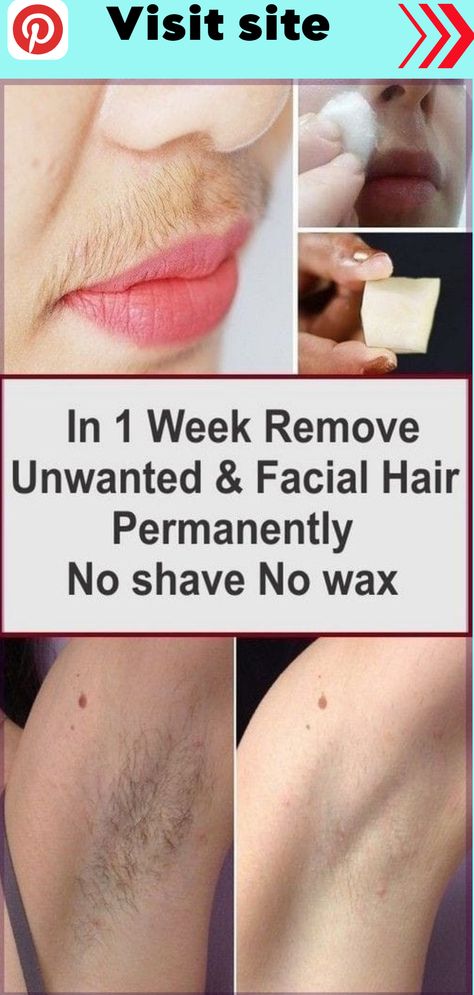 This natural recipe will remove hair from your face forever – live the glory Hypoglycemic Diet, Electrolysis Hair Removal, Upper Lip Hair, Unwanted Hair Permanently, Remove Unwanted Facial Hair, Underarm Hair Removal, Permanent Hair Removal, Unwanted Facial Hair, Remove Hair