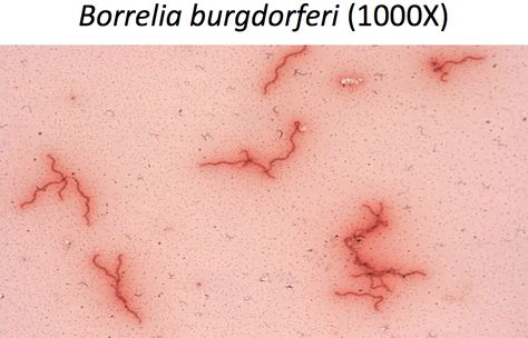 Borrelia burgdorferi, gram negative spirochete, can cause Lyme disease Borrelia Burgdorferi, Print Tattoos, Paw Print Tattoo, Paw Print, Disease